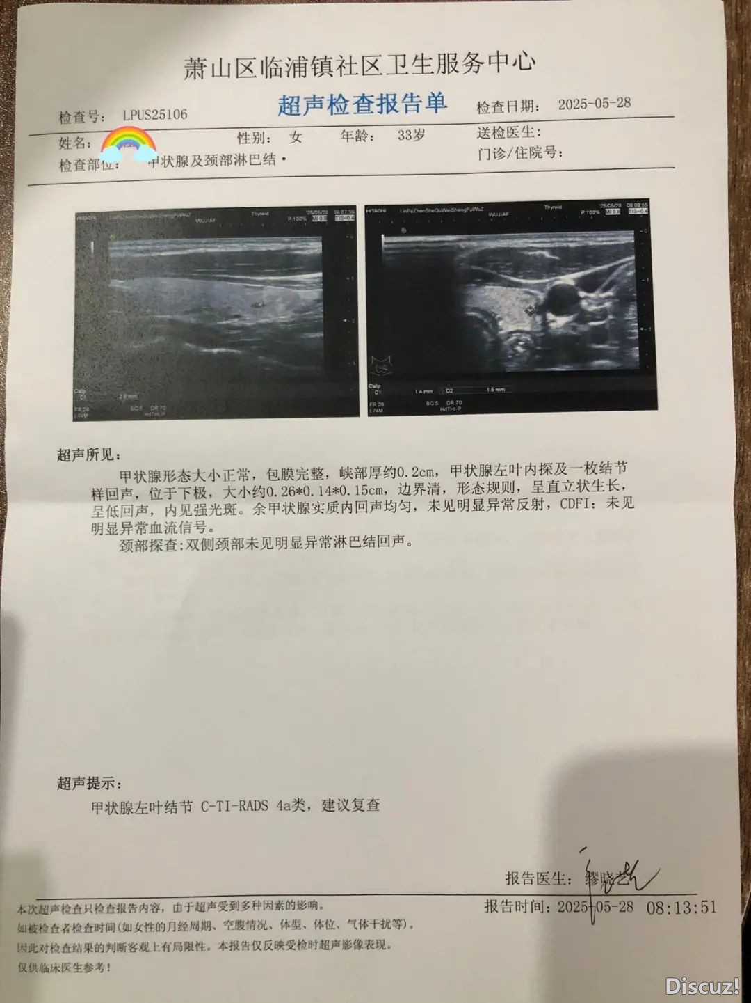 小革新年夜改动!DeepSeek R1新版调理真测超ChatGPTw13.jpg