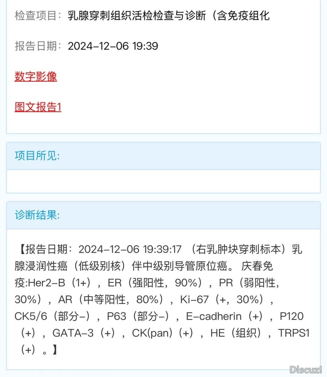 小革新年夜改动!DeepSeek R1新版调理真测超ChatGPTw29.jpg