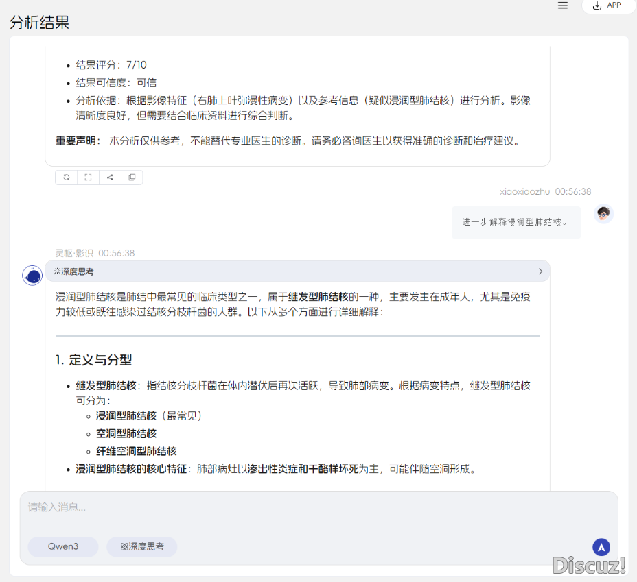 花10小时布置了DeepSeek,成果大夫只用3秒便否认了它:那没有是尔念要的AIw3.jpg